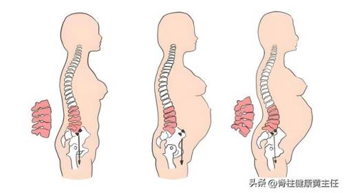 尾巴骨疼痛是什么原因(尾巴根疼是怎么回事男性)插图1 尾巴骨疼痛是什么原因(尾巴根疼是怎么回事男性)插图1