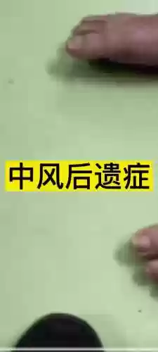 山中风技能书插图1