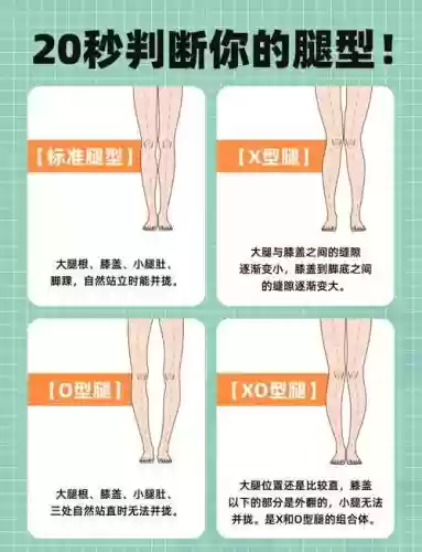 腿腿阵容_1插图1